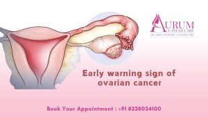 Early warning sign of ovarian cancer